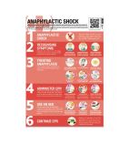 CX030 Food Allergies & Anaphylactic Shock Poster 59x42cm